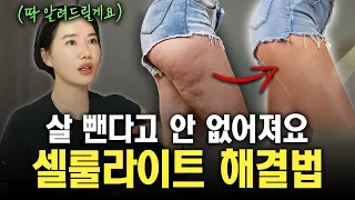 셀룰라이트의 실체, 알고 계시나요? 살 뺀다고 다 없어지지 않습니다!