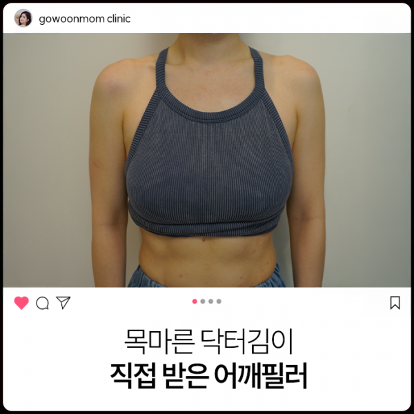 목마른 닥터김이 직접 받은 어깨필러