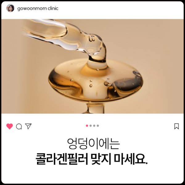 엉덩이에는 콜라겐필러 맞지 마세요.