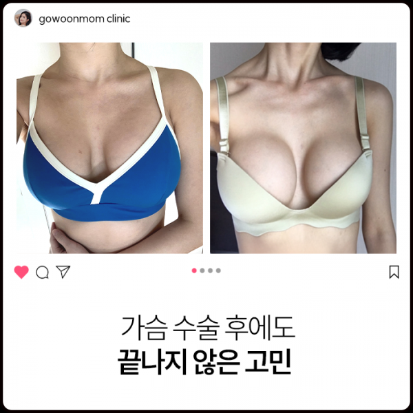 가슴 수술 후에도 끝나지 않은 고민