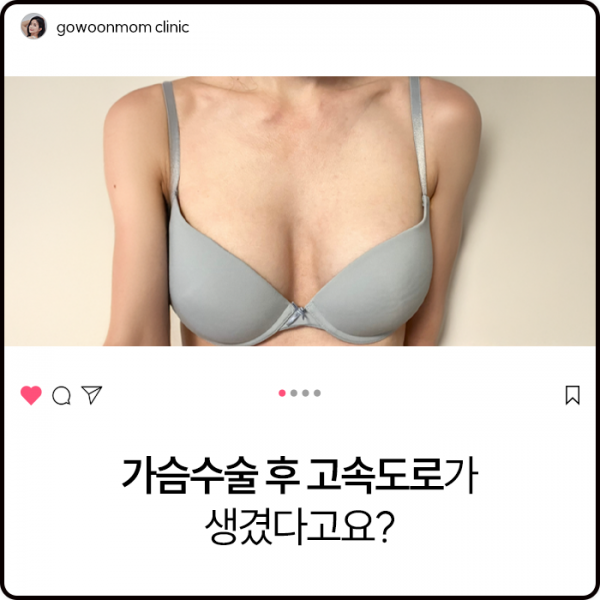 가슴수술 후 고속도로가 생겼다구요 ?!